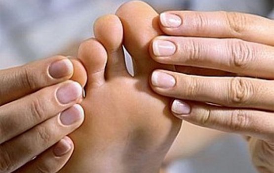 Hallux valgus,    